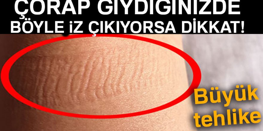 Kalbinizin düzgün çalışmadığını gösteren 8 işaret