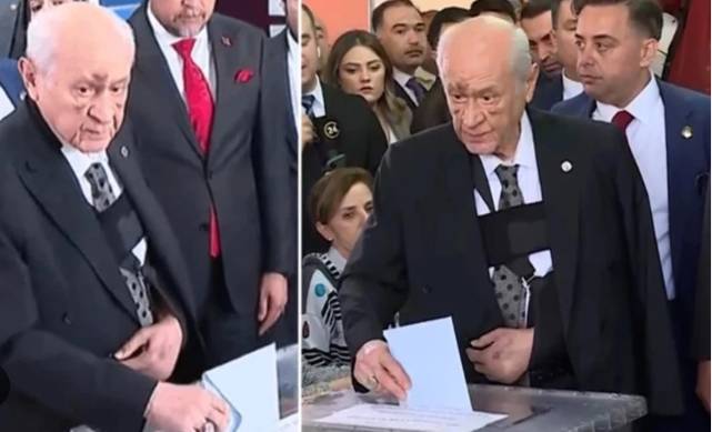 Bahçeli’nin Yüzündeki Morlukların Sebebi Açıklandı 2