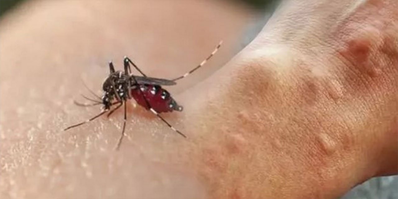 Sivrisinek ısırıkları nasıl geçer? Sivrisinek kızarıklıkları nasıl tedavi edilir?