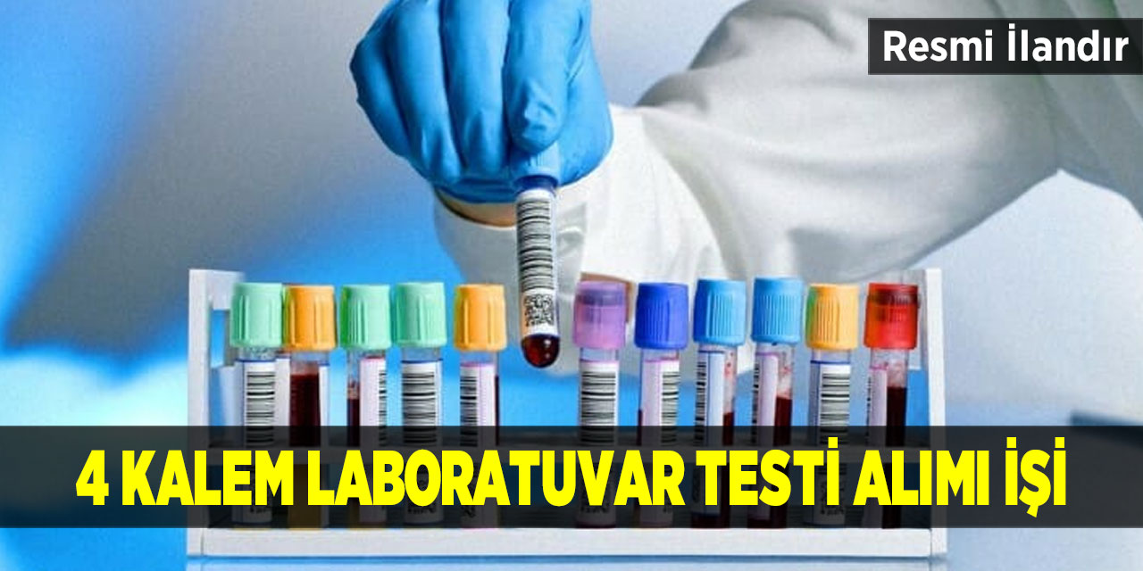 4 kalem laboratuvar testi alımı işi