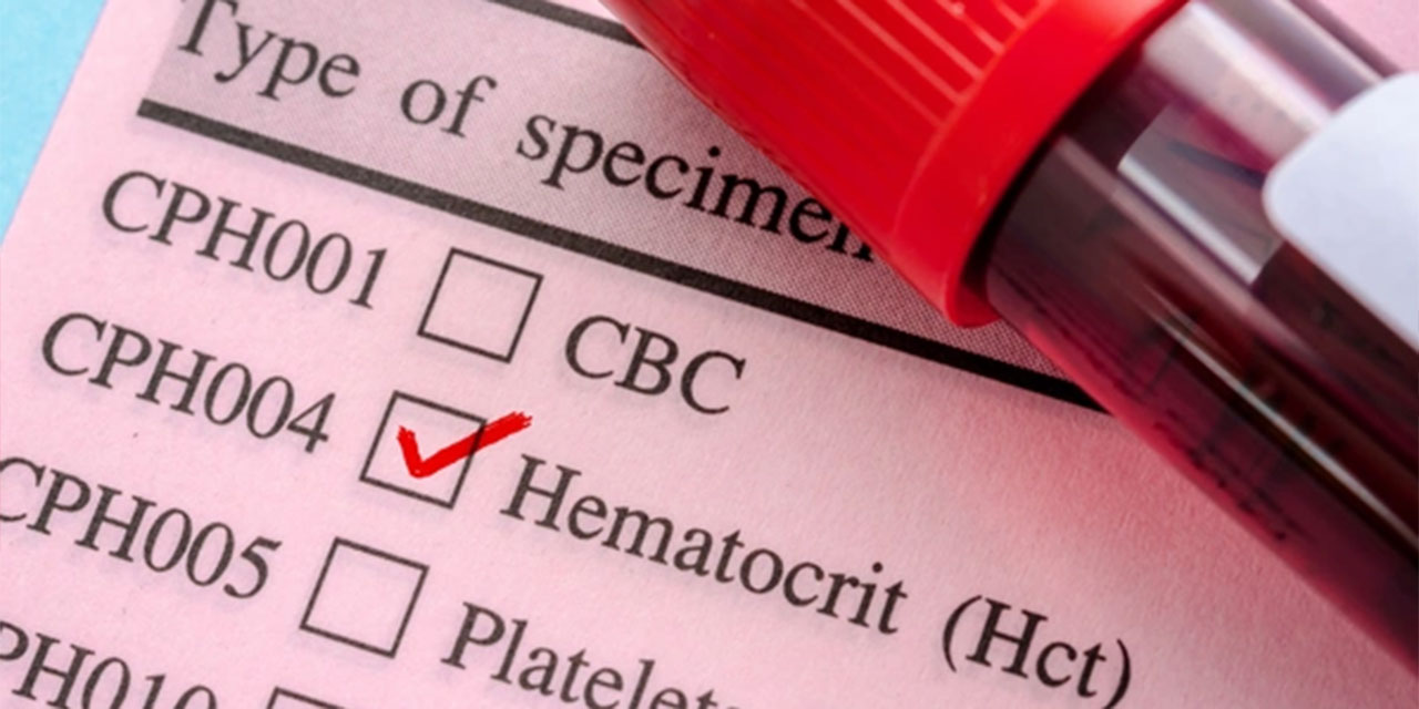 Hematokrit nedir? Hematokrit yüksekliği ve düşüklüğü neden olur?