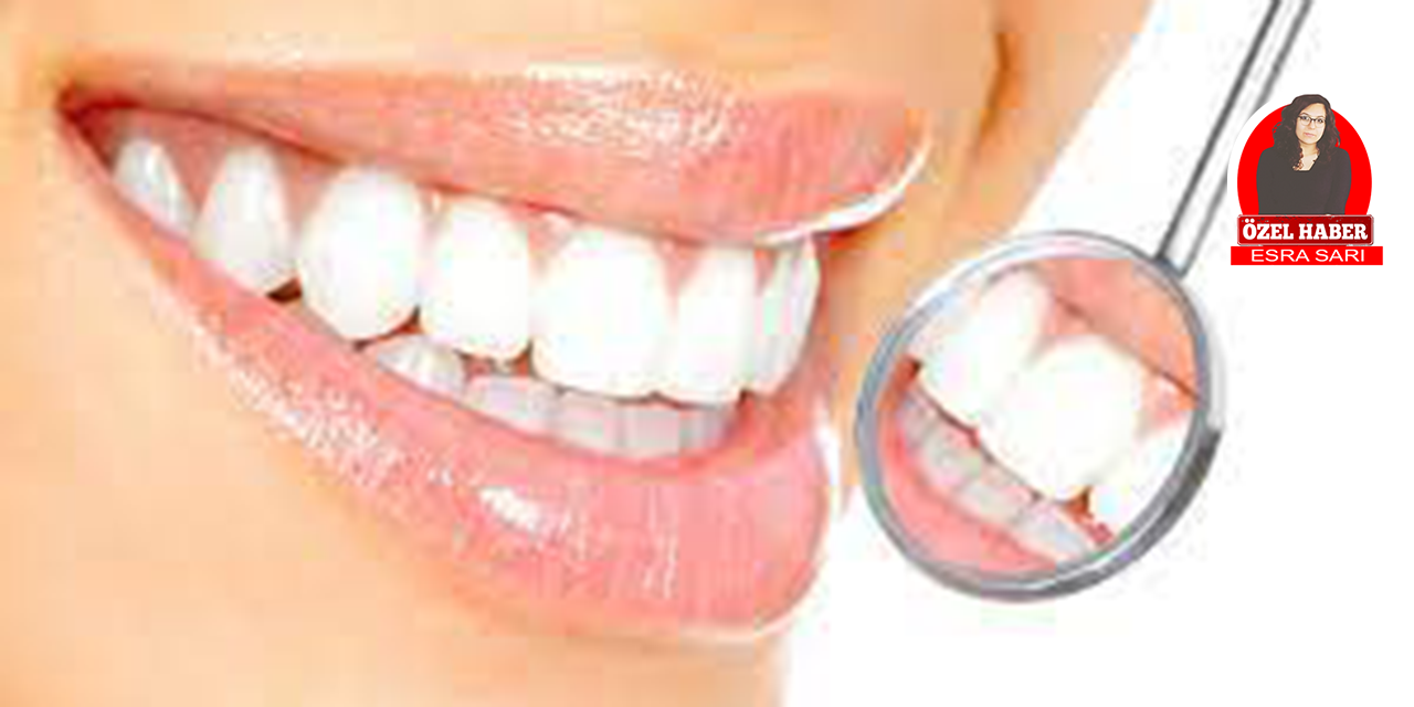 Dişlerde oluşan kahverengi lekeler nasıl geçer?