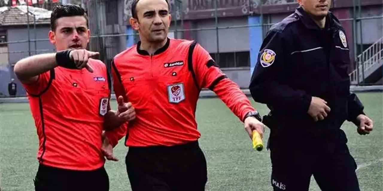 Gençlerbirliği'nin bu hafta maçını yönetecek hakemin burnu ısırılmıştı: Furkan Aksuoğlu'nu hatırladınız mı?