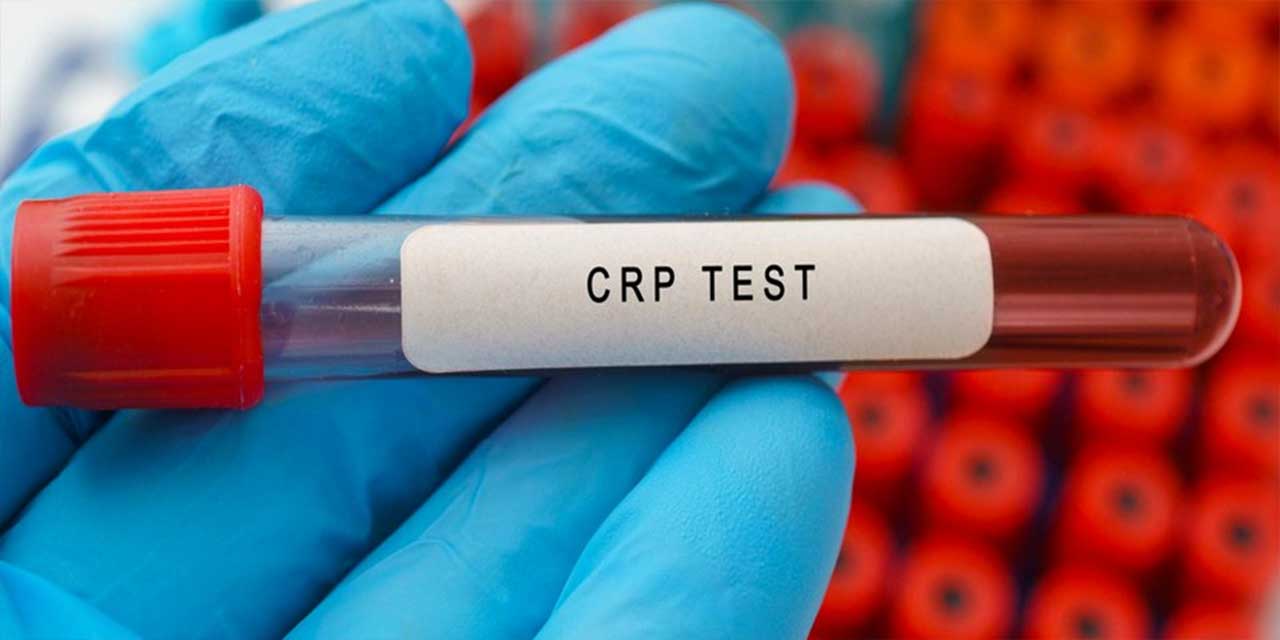 C-Reaktif Protein (CRP) Nedir?