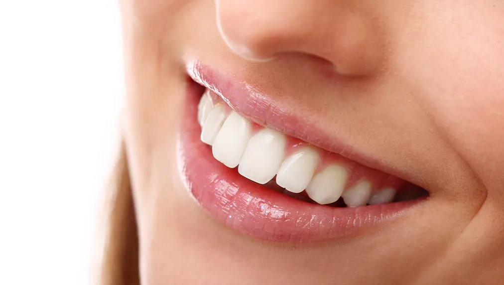 Diş beyazlatma yöntemleri nelerdir?