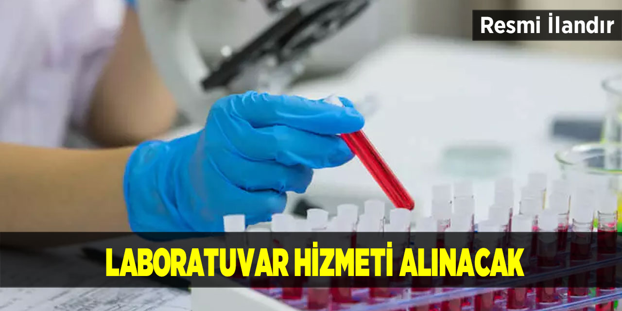 Laboratuvar hizmeti alınacak