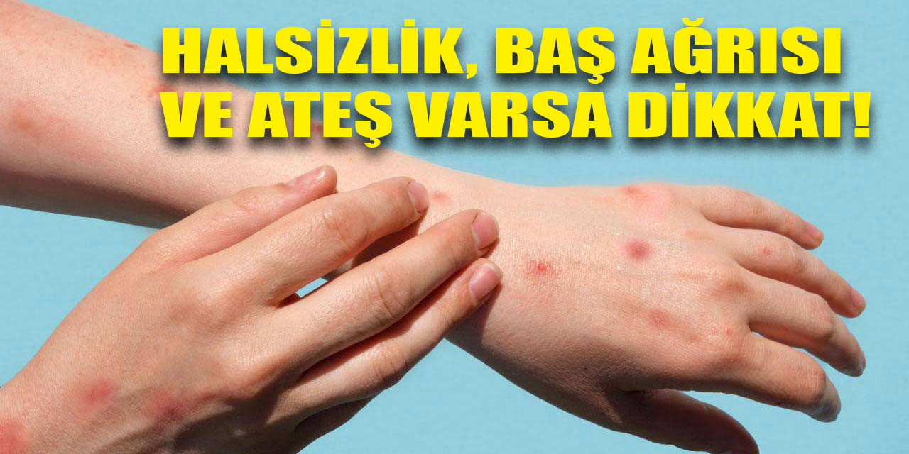 Halsizlik, baş ağrısı ve ateş: Bu belirtiler varsa dikkat!