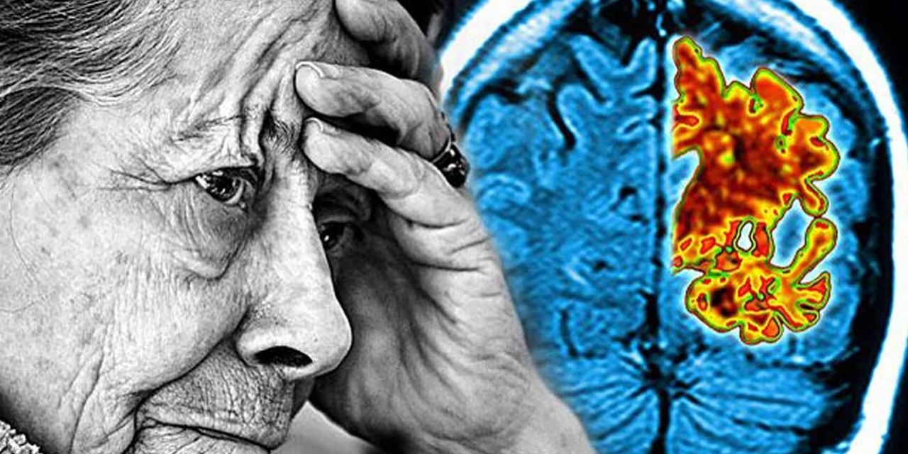 Nöroloji Uzmanı Dr. Ümit Eren: Genç yaşta başlayan alzheimerın belirtilerini sıraladı