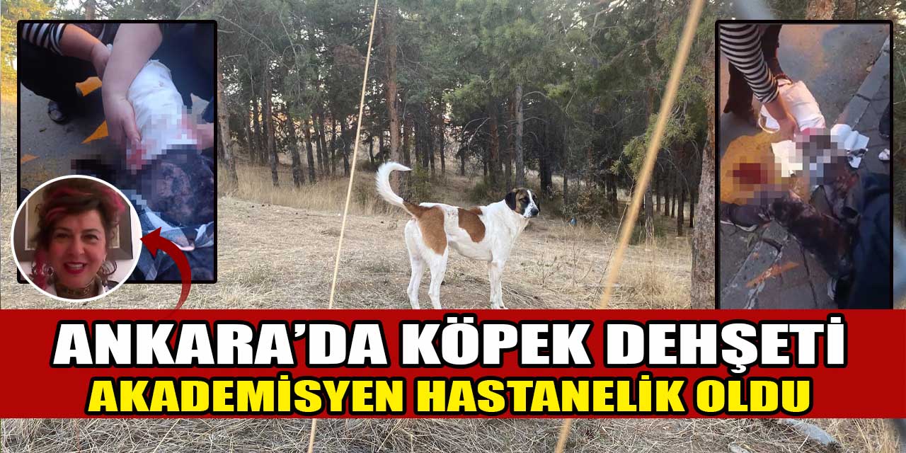 Ankara'da akademisyene sokak köpekleri saldırdı: Çankaya'da 9 köpeğin saldırısına uğrayan kadın hastaneye kaldırıldı