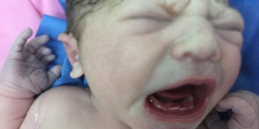 Amasya'da bebek dişleriyle doğdu