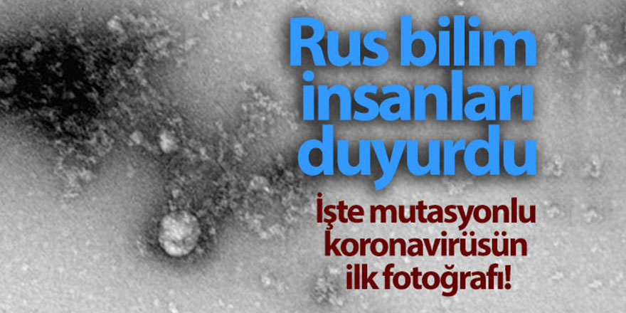 Rusya'da, korona virüs mutasyonunun fotoğrafı çekildi