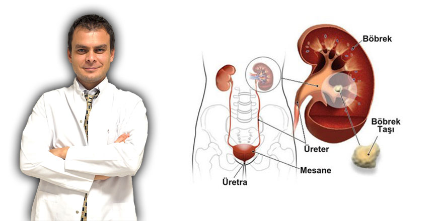 Böbrek taşlarına dikkat
