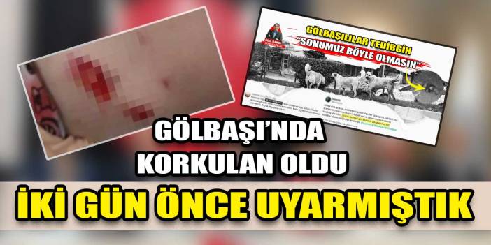 Ankara Gölbaşı'nda sokak köpeği 5 yaşındaki kıza saldırdı!